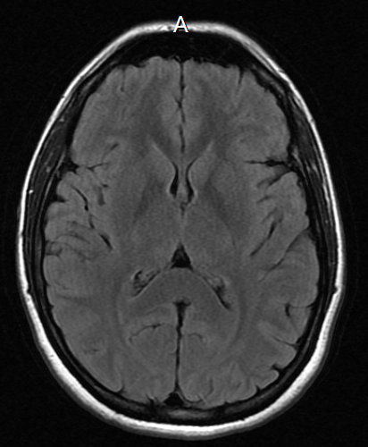 This is your brain on the Wonderland Trail